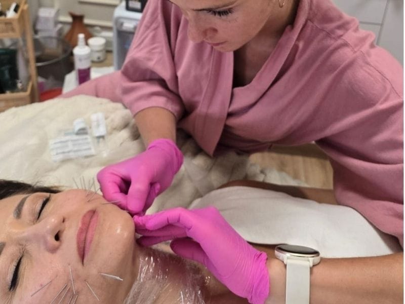 Efekty Needle Shaping – czego się spodziewać?