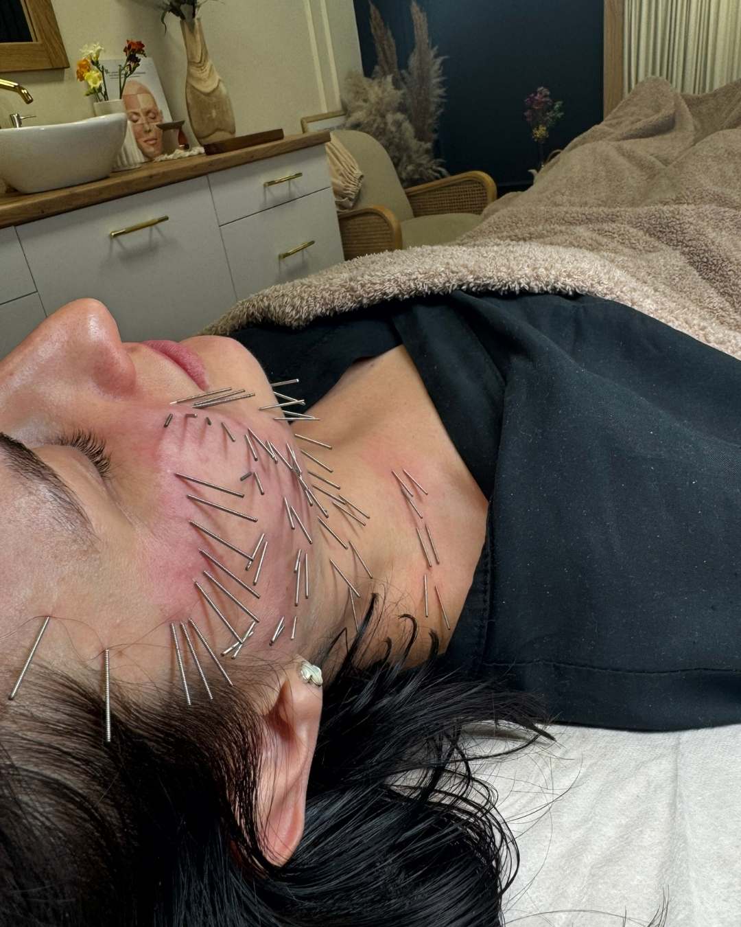 Gabinet kosmetologiczny Rzeszów - Karolina Jagielska, certyfikowana specjalistka Needle Shaping na Podkarpaciu